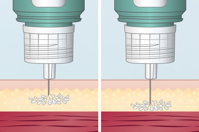 Short pen needles - reliable absorption