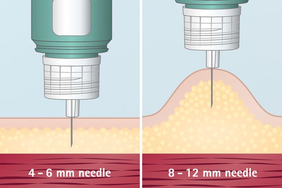 Needle length - do