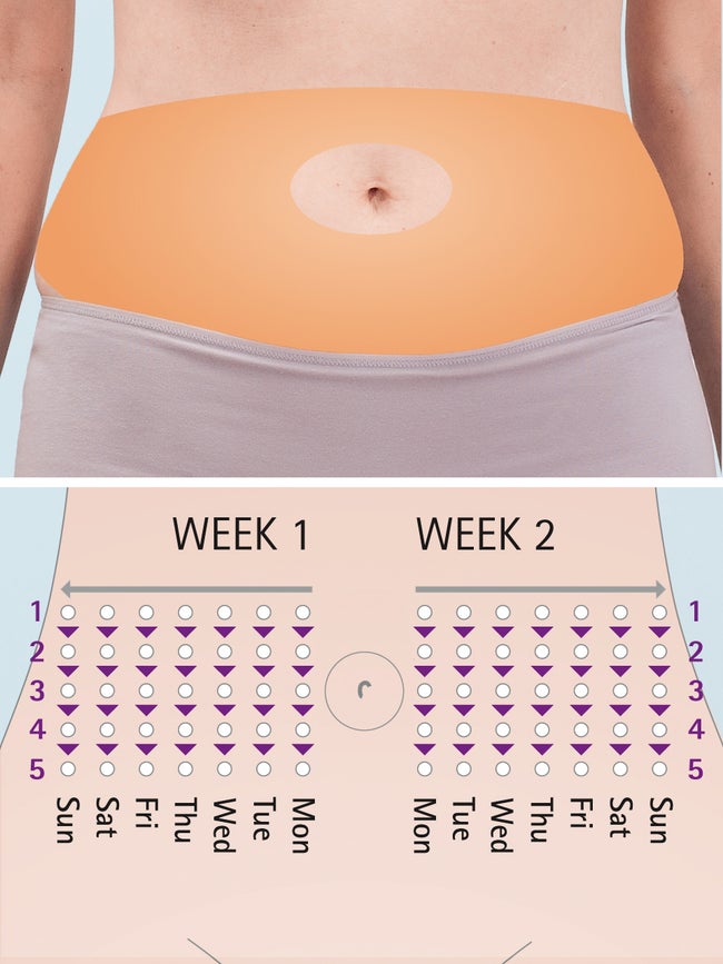 Site rotation - abdomen