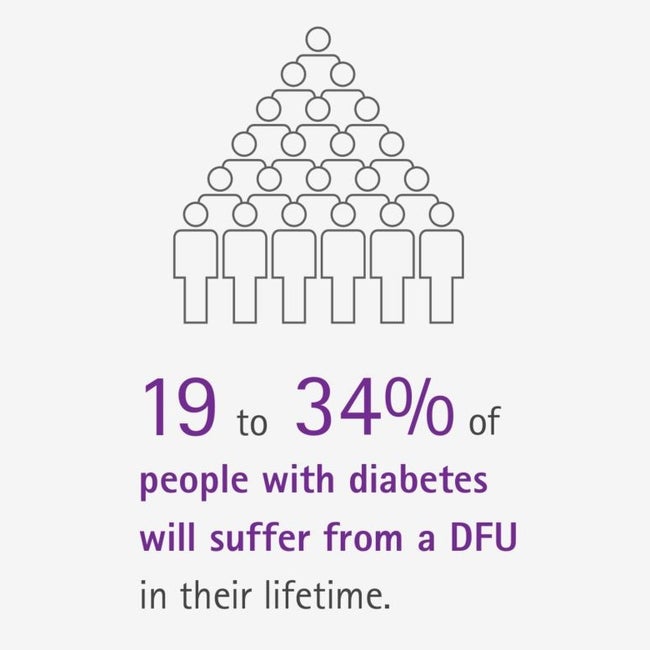 25% of people with diabetes will develop a DFU during their lifetime