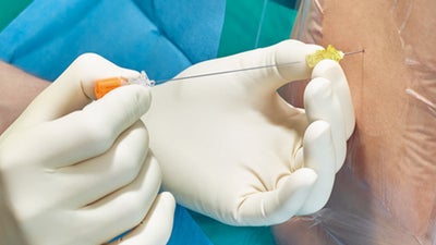 Spinal Anesthesia