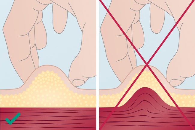 Choice of needle - how to pinch up